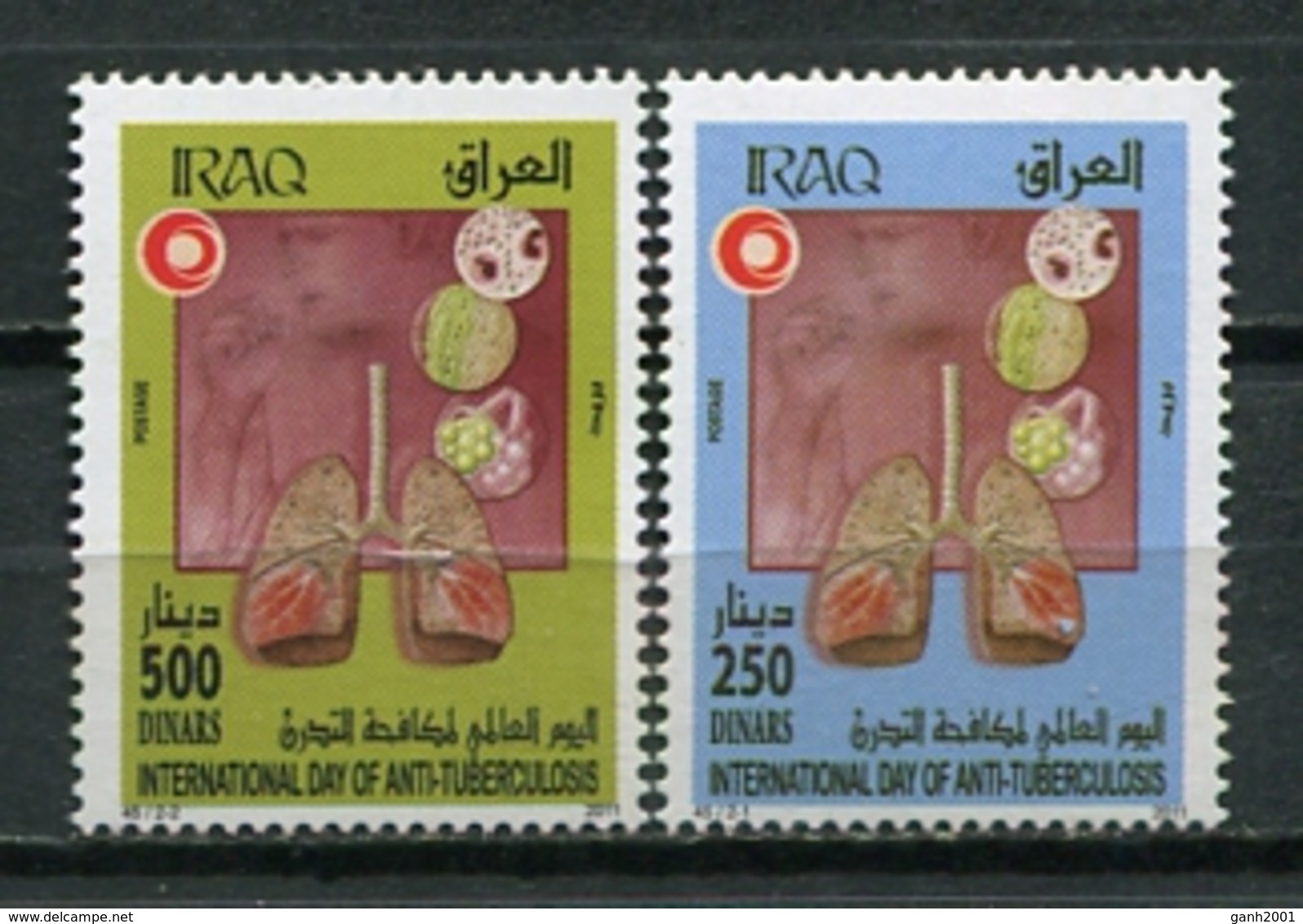 Iraq 2011 / Tuberculosis Medicine MNH Medicina Medizin Tuberkulose / Cu8730  41-11 - Krankheiten