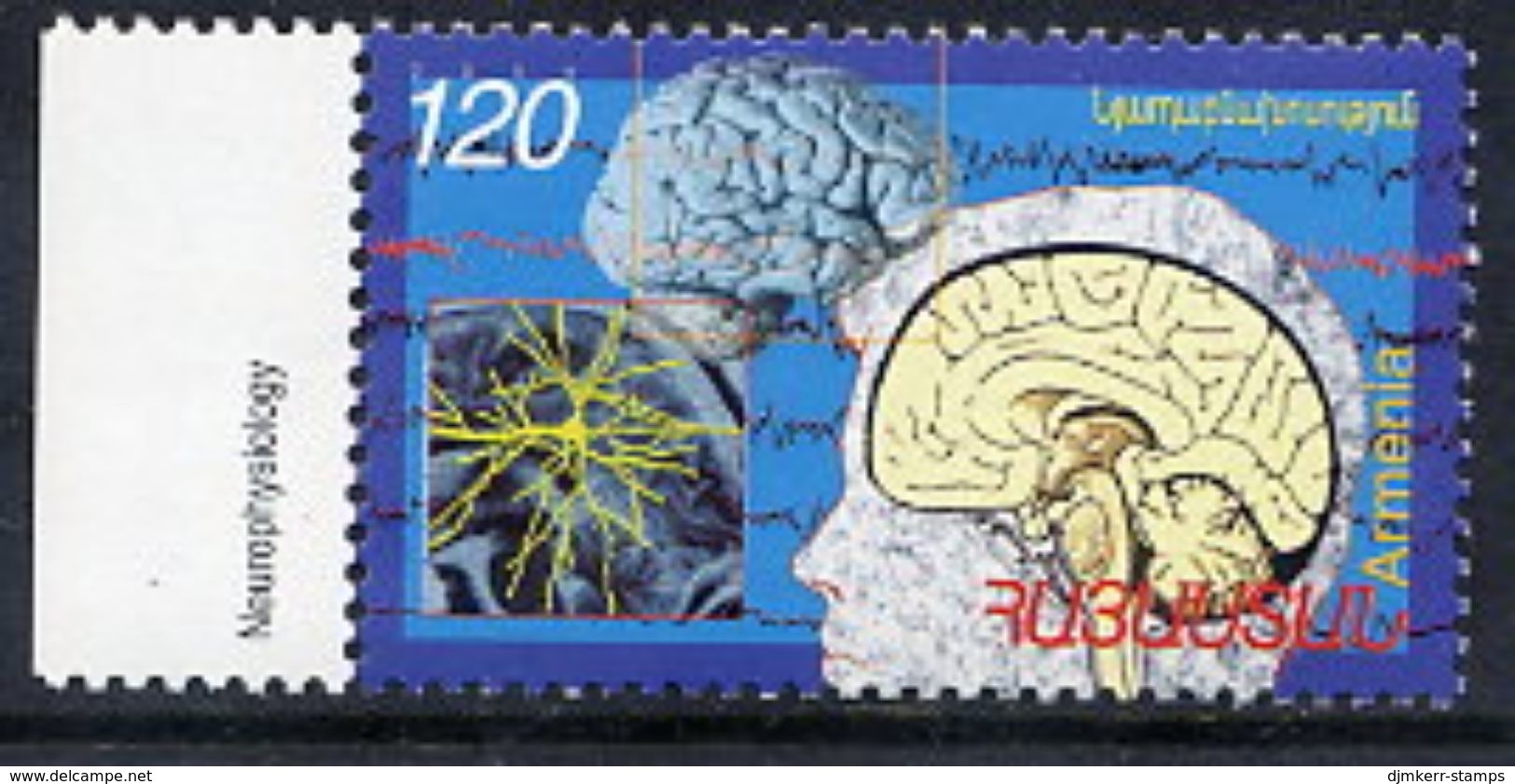 ARMENIA 2003 Neurophysiology MNH / ** - Armenia