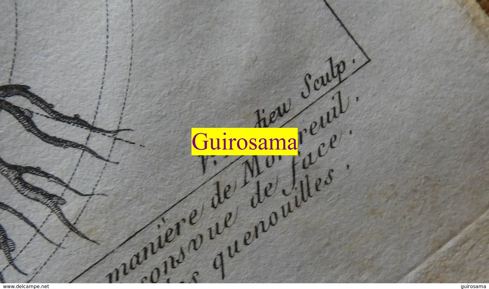 Taille Des Arbres : Planche Du Nouveau Dictionnaire D'histoire Naturelle - 1803 - Estampes & Gravures