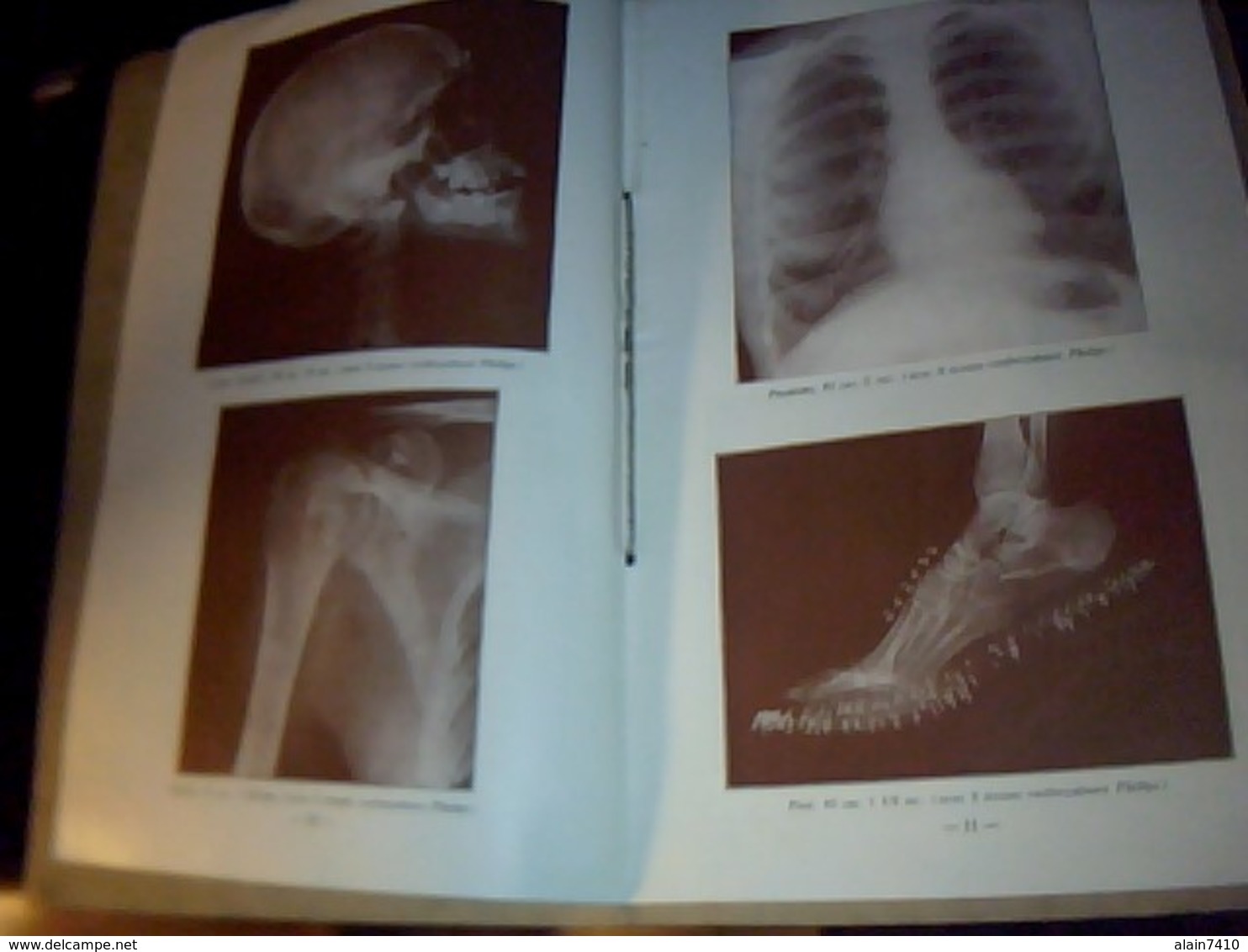 livret technique publicitaire materiel medical ancien PORTATIF A  RAYON X PHILIPS  METALIX  19 pages annee1930