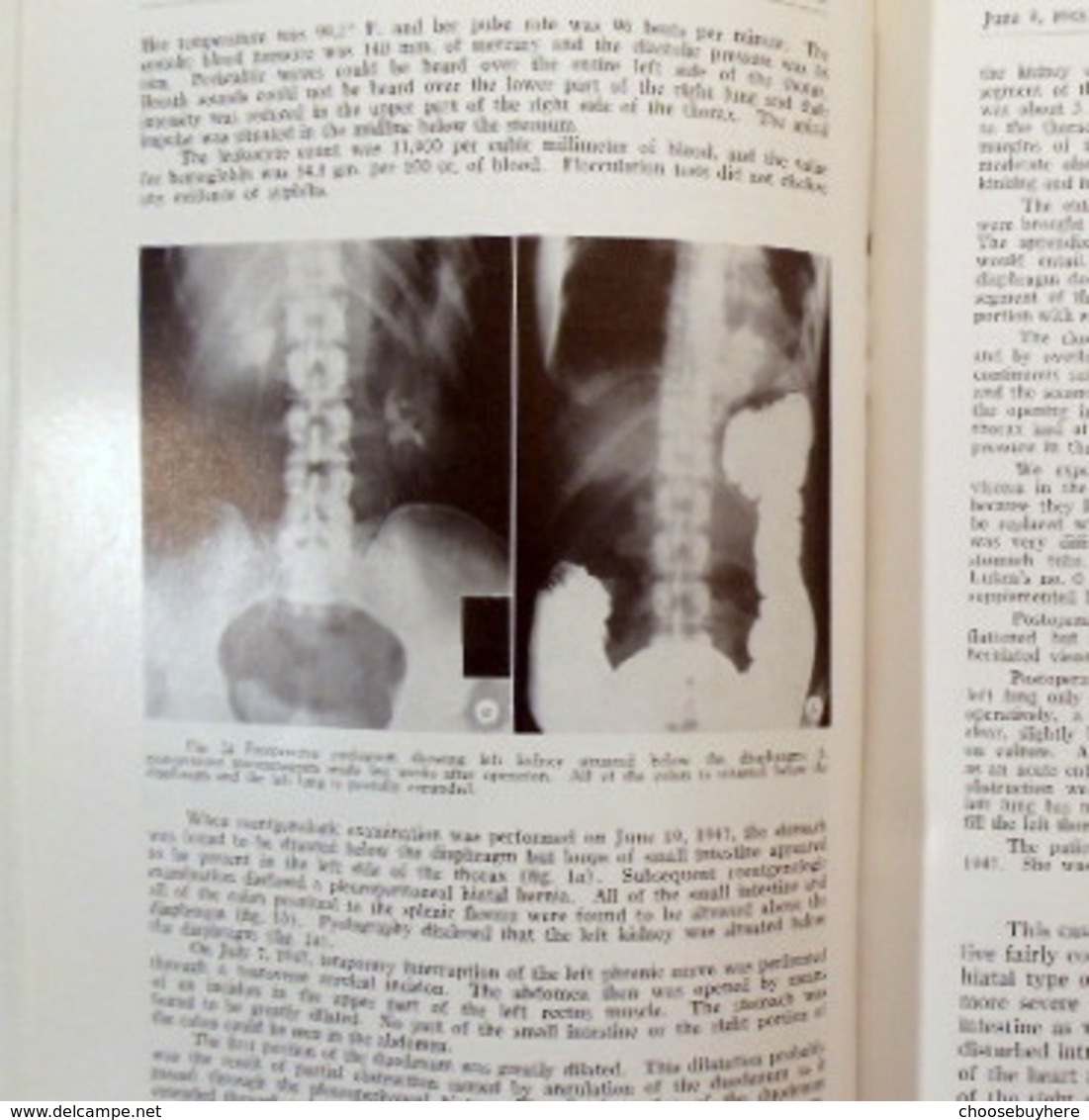 Proceedings Of The Staff Meetings Of The Mayo Clinic Volume 23 1948 - Altri & Non Classificati