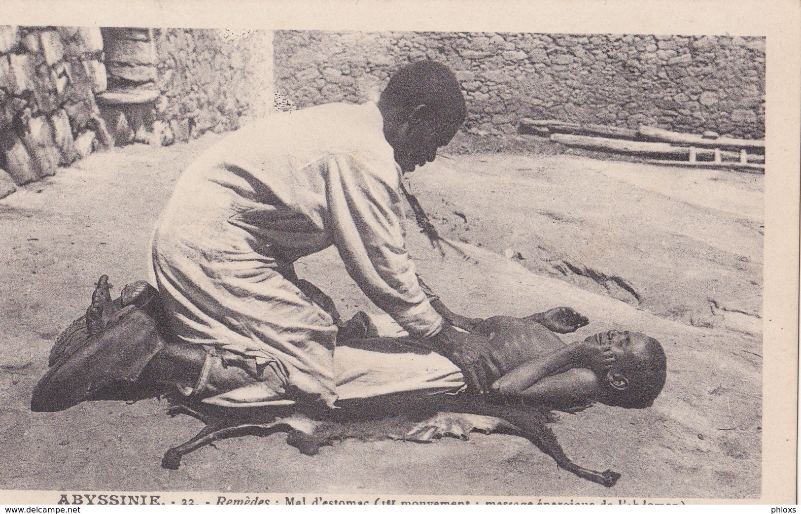 ABYSSINIE/Remèdes: Mal D'estomac (1er Mouvement:massage énergique De L 'abdomen) Réf:fm871 - Ethiopie