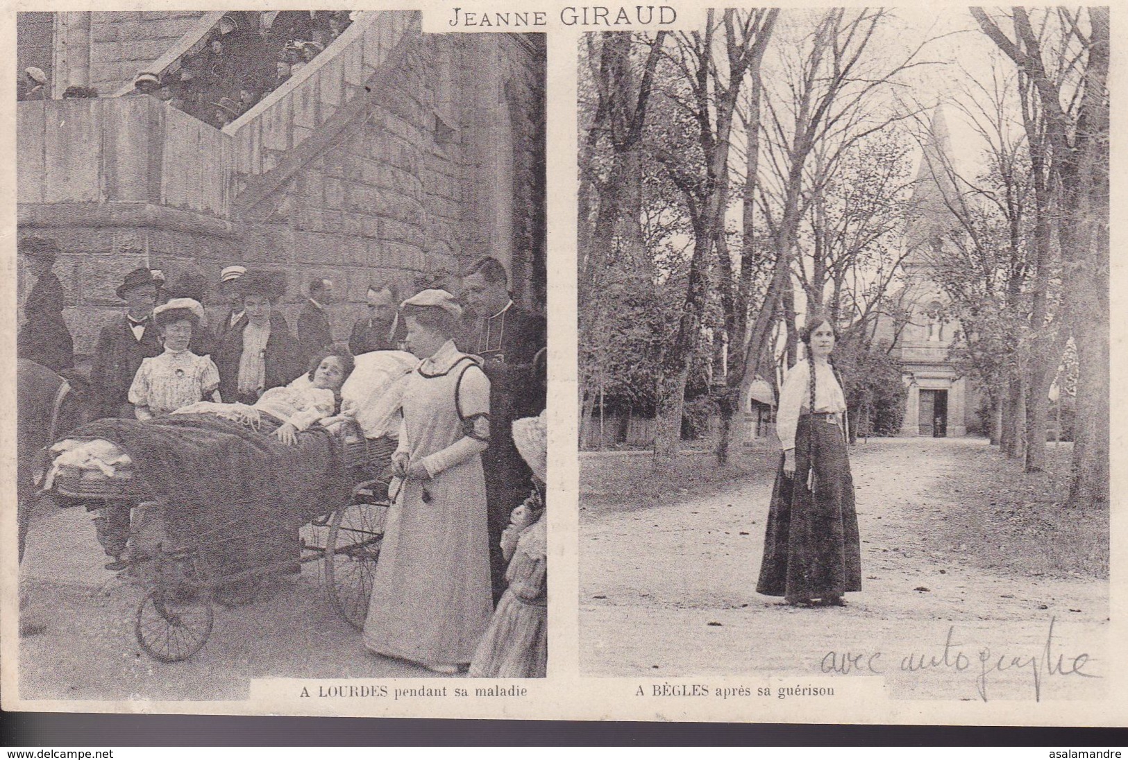 GIRONDE – BEGLES – Jeanne Giraud – Avant Et Après Sa Guérison - Autres & Non Classés