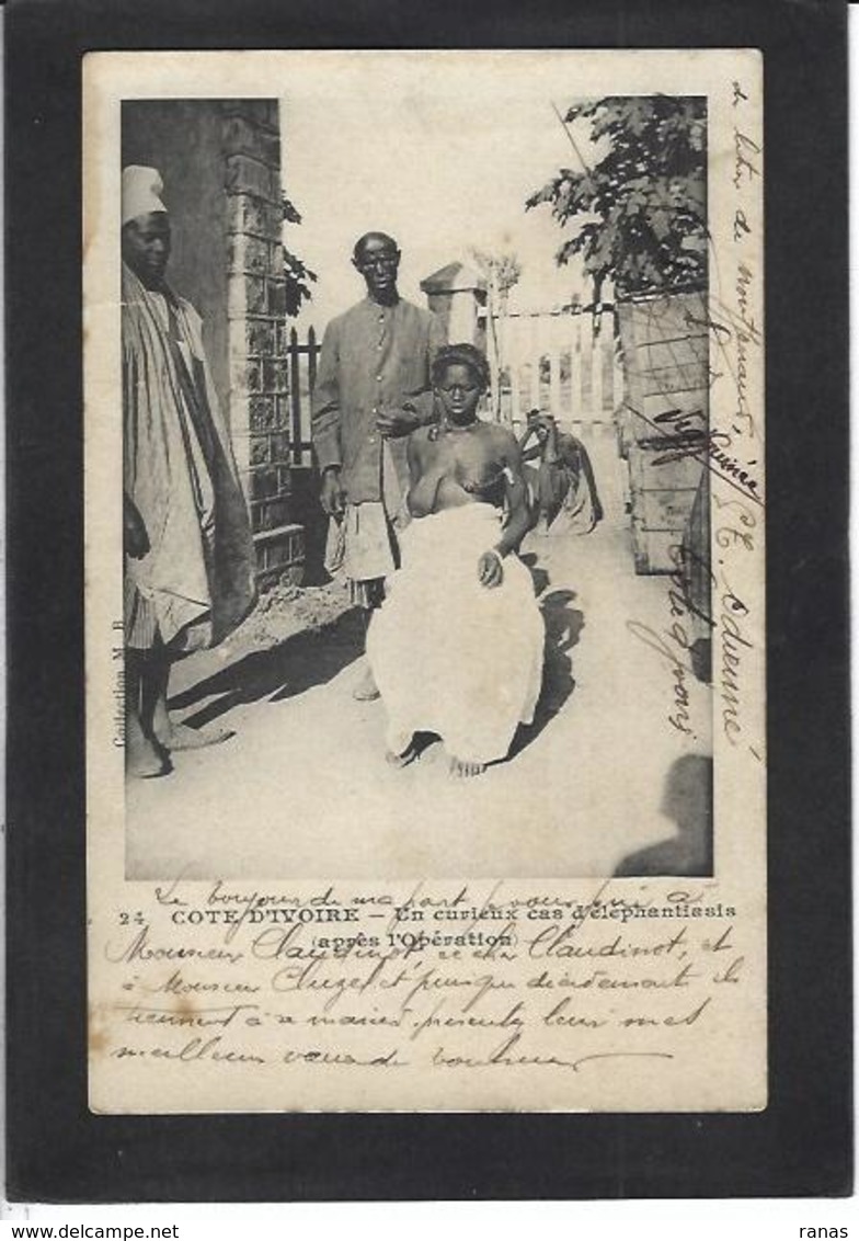 CPA Côte D'Ivoire Afrique Noire Type Ethnic écrite Femme Nue éléphantiasis Médecine Opération - Côte-d'Ivoire