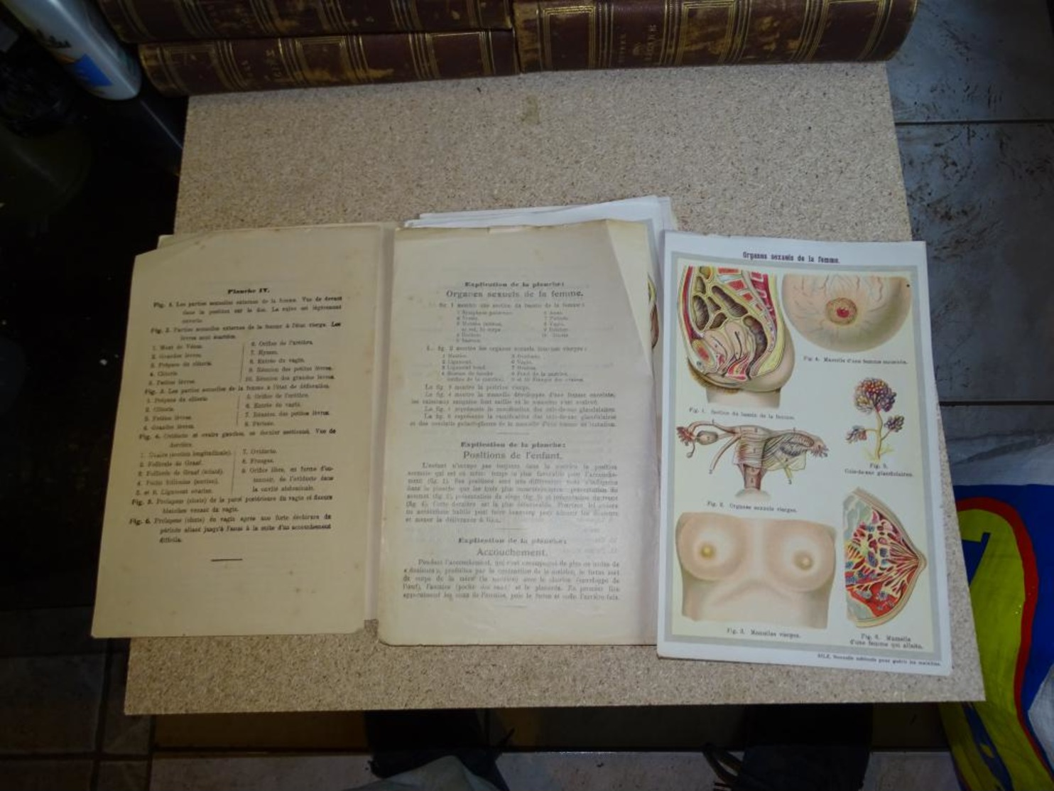 Vieux Port Folio - BILZ Anatomie Du Corps Humain Grand Modèle Démontable De La Femme En Cours De Gestation Planche Anato - Santé