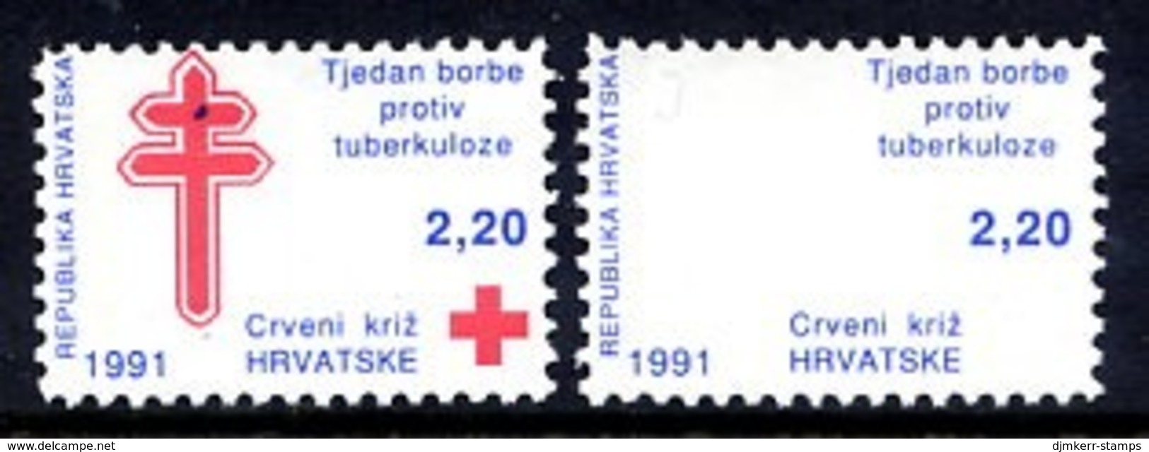 CROATIA 1991 Obligatory Tax: Anti Tuberculosis Week, Red Printing Omitted  MNH / ** .  Michel ZZM 12 - Croatia