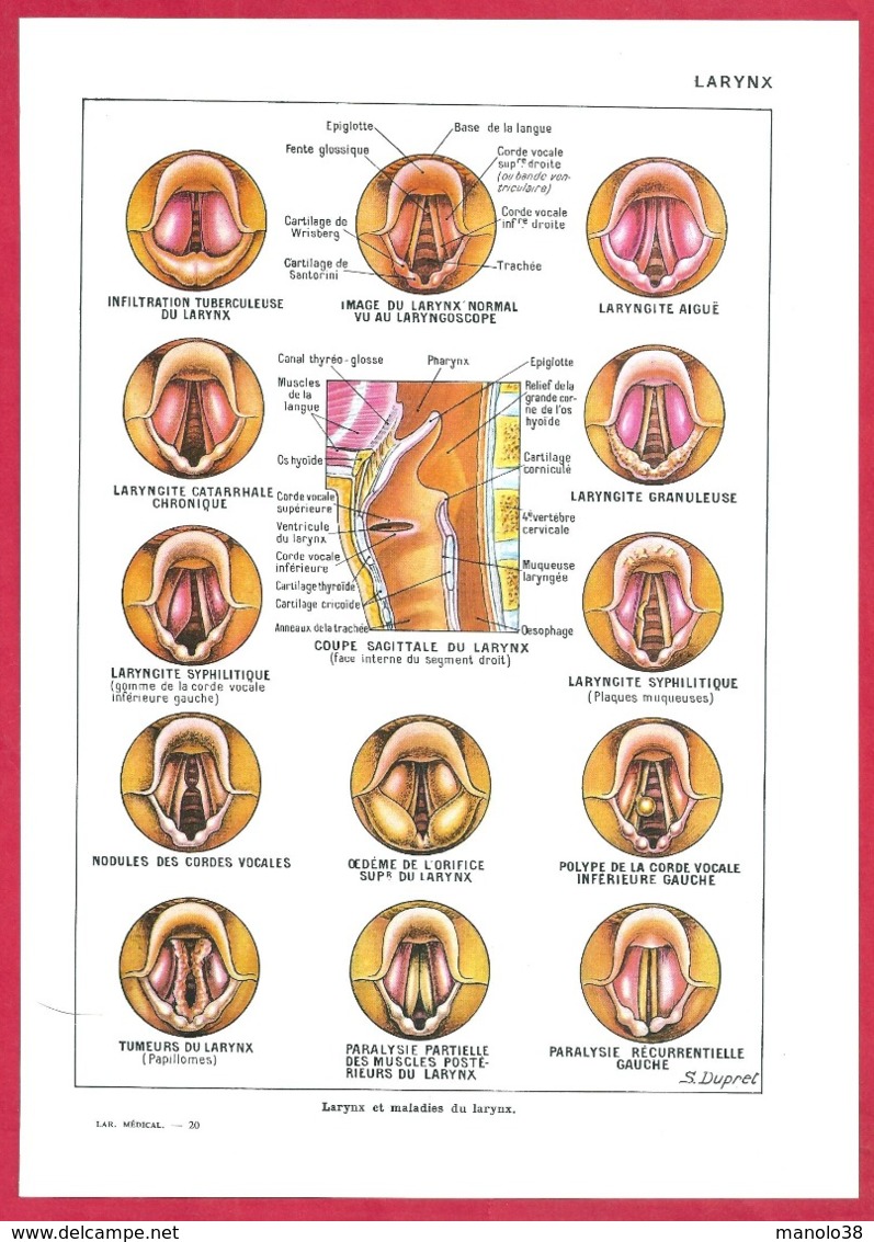 Larynx. Larynx Et Maladies Du Larynx. Illustration S Dupret. Larousse Médical 1974. - Non Classés