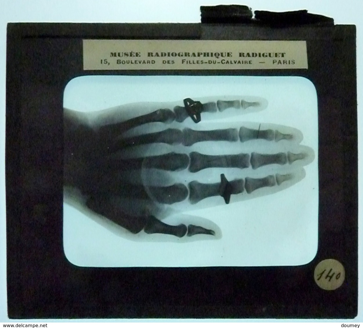 MUSÉE RADIOGRAPHIQUE " RADIGUET " - Glass Slides