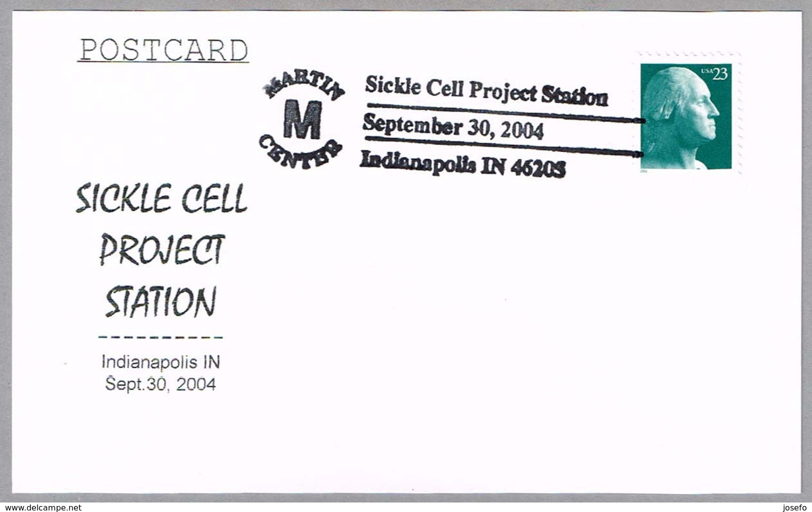 ANEMIA DE CELULAS FALCIFORMES - SICKLE CELL. Indianapolis IN 2004 - Enfermedades