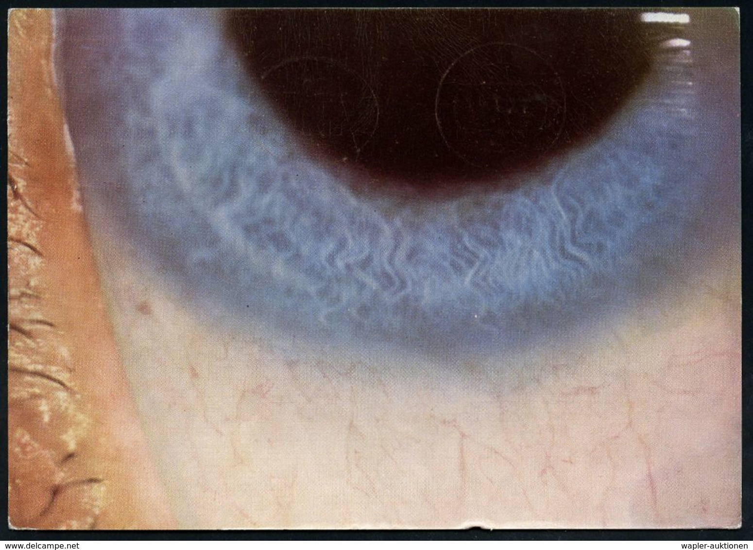 AUGE / OPHTALMOLOGIE / BLINDHEIT : (14b) BIBERACH (RISS)/ Geigy 1953 (13.7.) AFS Auf Color-Reklame-Kt.: IRGAMID-Augensal - Disease