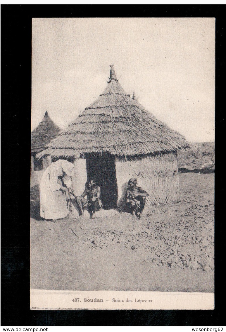 SOUDAN Soins Des Lépreux Ca 1910 Old Postcard - Sudan