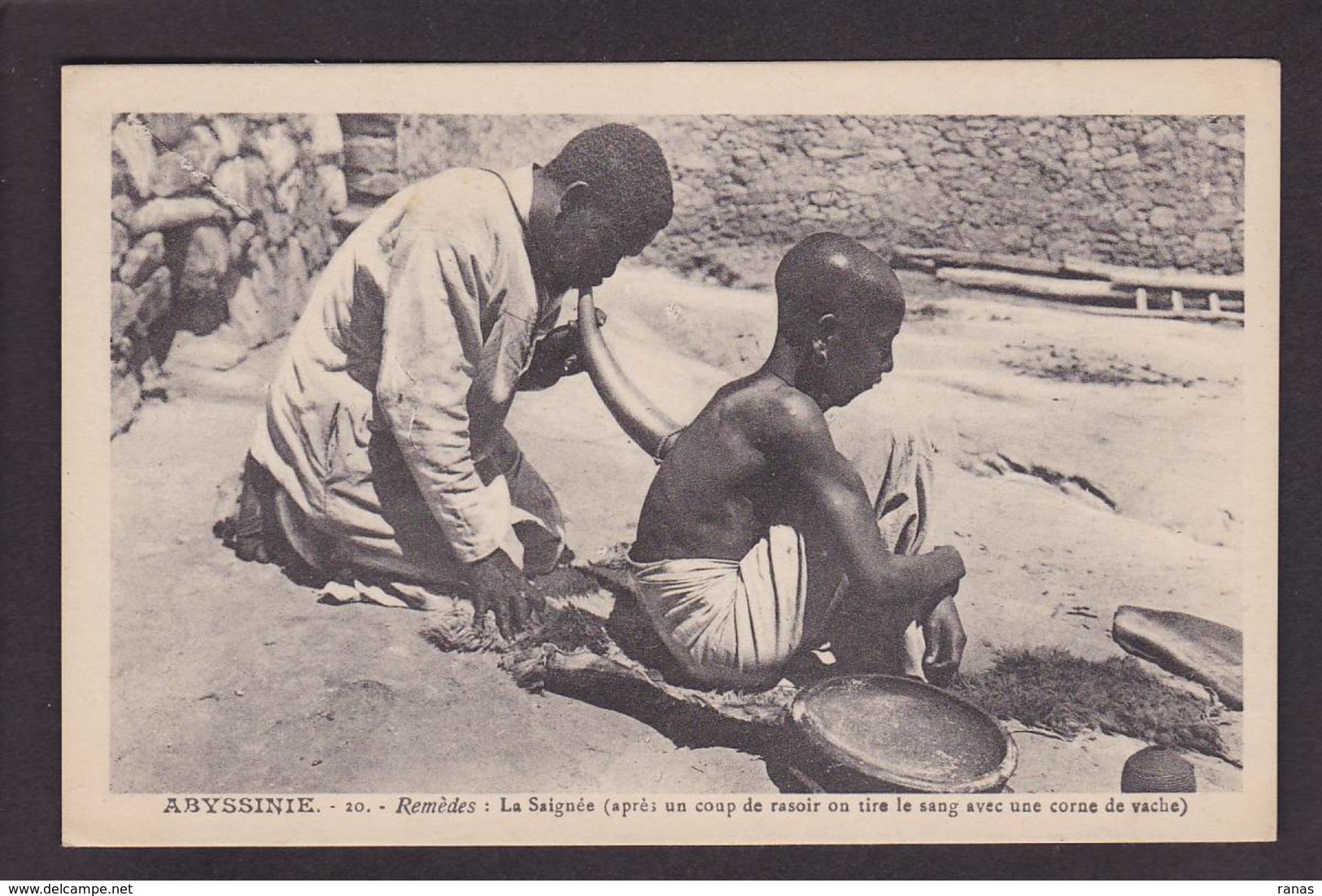 CPA Ethiopie Ethiopia Afrique Noire Abyssinie Types Non Circulé Médecine - Äthiopien