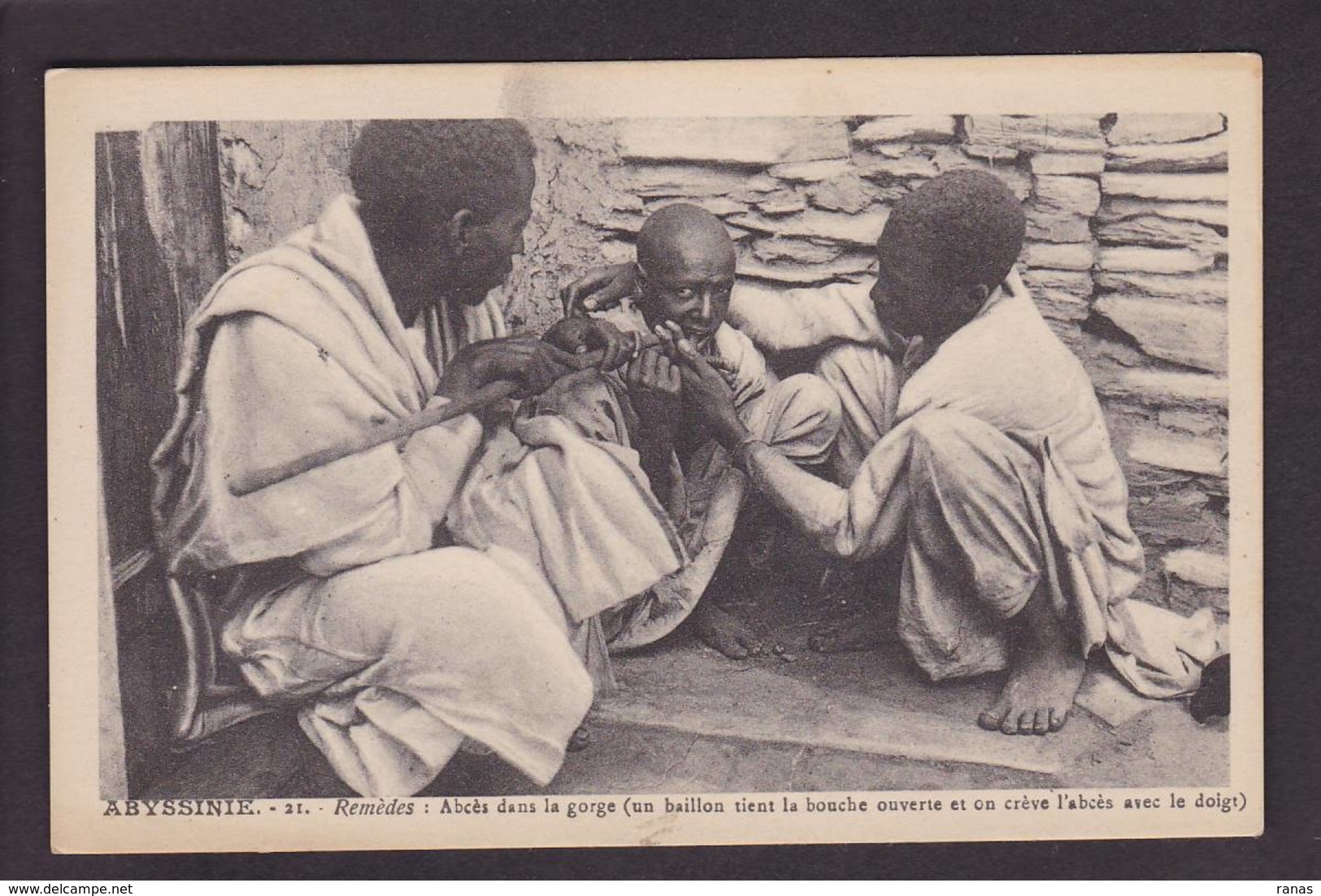 CPA Ethiopie Ethiopia Afrique Noire Abyssinie Types Non Circulé Médecine - Etiopía