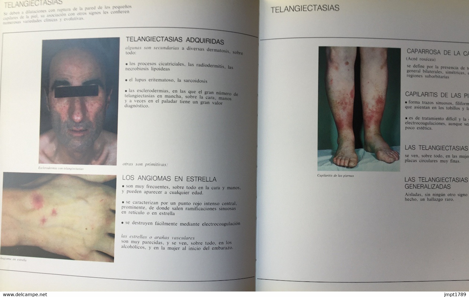Dermatología Práctica Diprogenta Diproderm. Dr. F Daniel. Schering 1973 Dermatologie - Santé Et Beauté