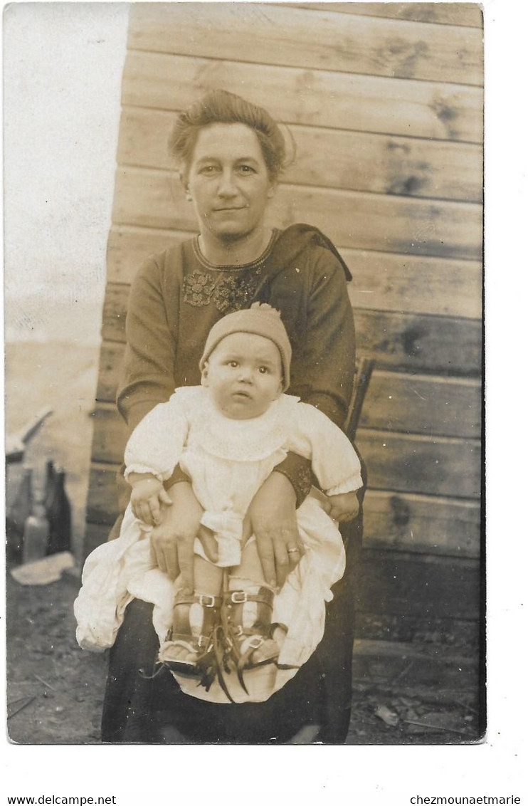 UN BEBE AVEC DES ATTELES AUX PIEDS - CARTE PHOTO - Histoire