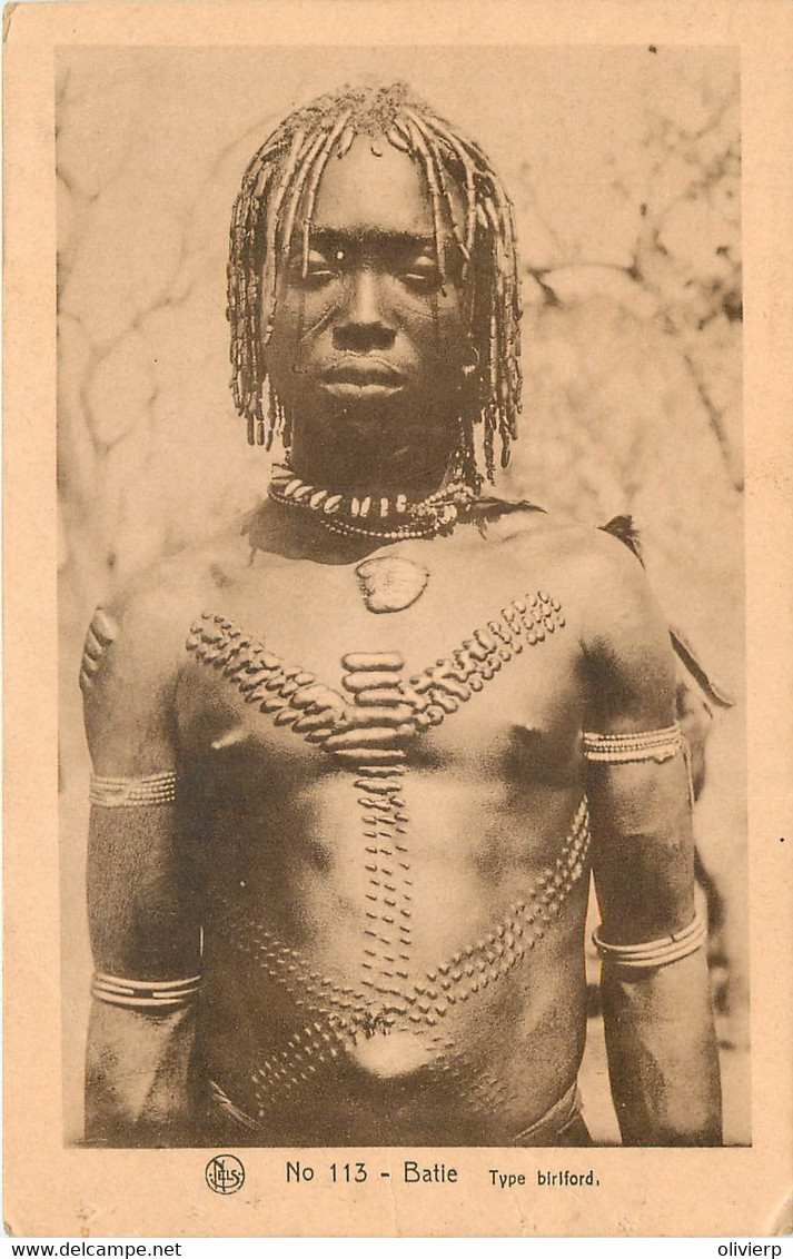 Cameroun - Tatouages - Batie - Type Biriford - Cameroun