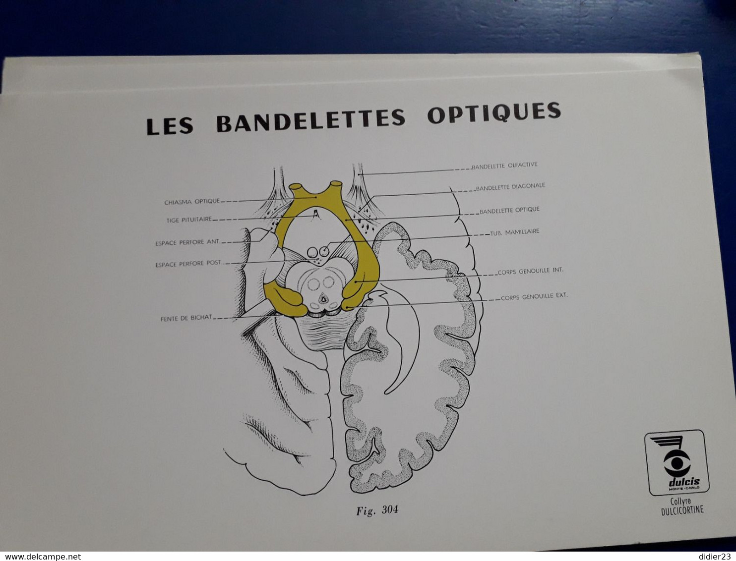 LABORATOIRE OPTHAMOLOGIE DULCIS MONTE CARLOS  SHEMA DE L'OEIL