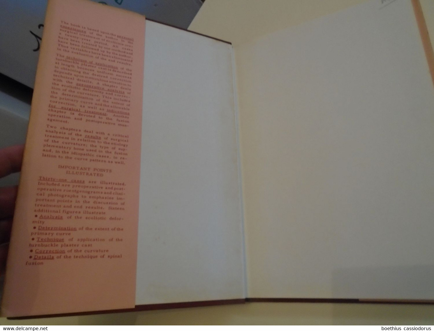 SURGERY MEDICINE : SURGICAL TREATMENT OF SCOLIOSIS L A GOLDSTEIN,  APPENDIX ANESTHESIA IN SCOLIOSIS D V THOMAS (1959 ?) - Cirugia