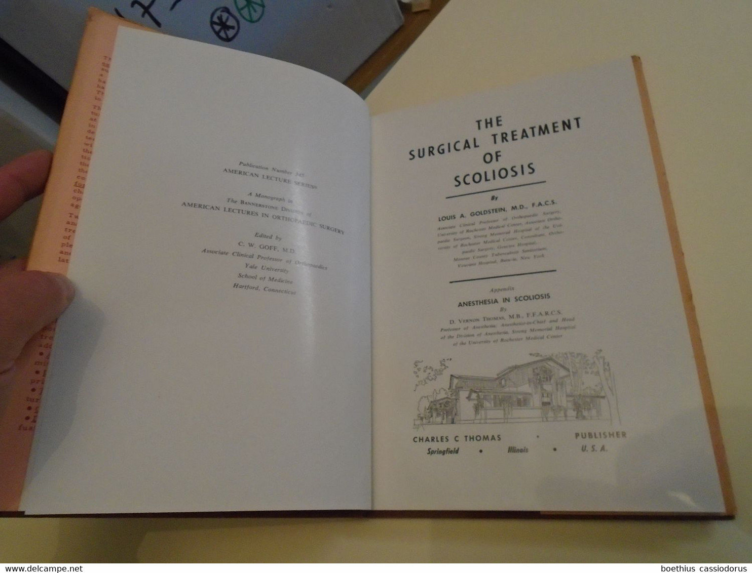 SURGERY MEDICINE : SURGICAL TREATMENT OF SCOLIOSIS L A GOLDSTEIN,  APPENDIX ANESTHESIA IN SCOLIOSIS D V THOMAS (1959 ?) - Chirurgia