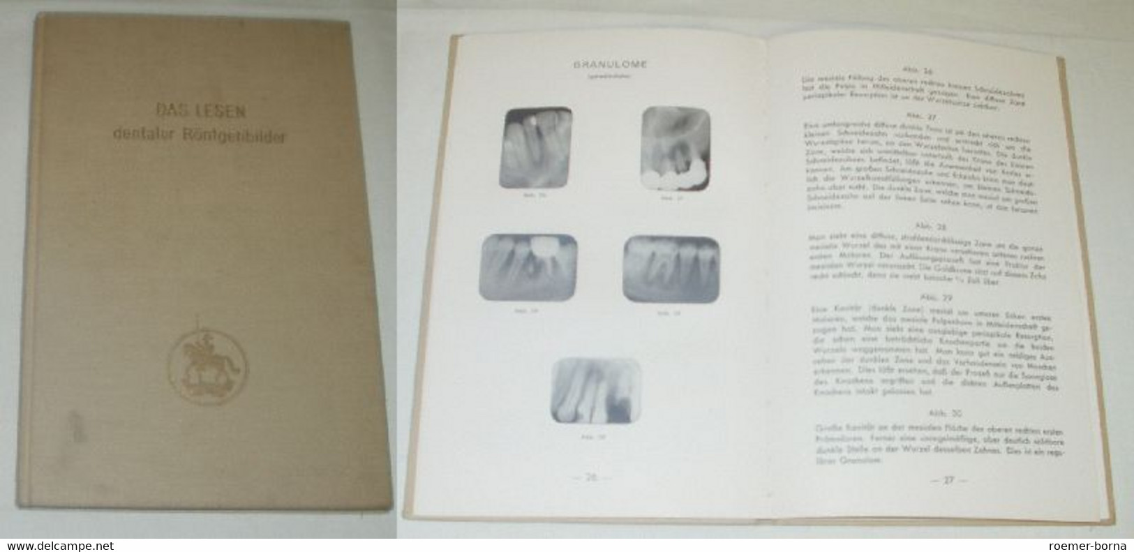 Das Lesen Dentaler Röntgenbilder - Gezondheid & Medicijnen