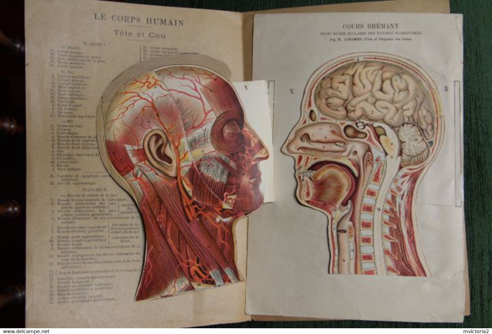 MEDECINE : Superbe Planche De Figures Superposées, Cours Brémant : Musée Scolaire : Tête Et Cou. - Other Plans