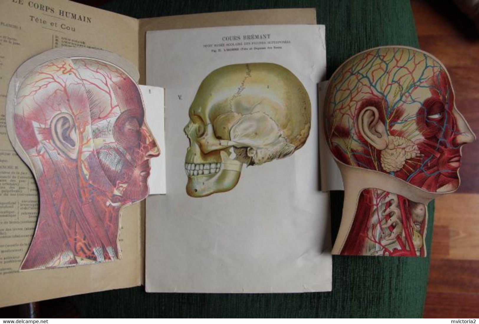 MEDECINE : Superbe Planche De Figures Superposées, Cours Brémant : Musée Scolaire : Tête Et Cou. - Autres Plans