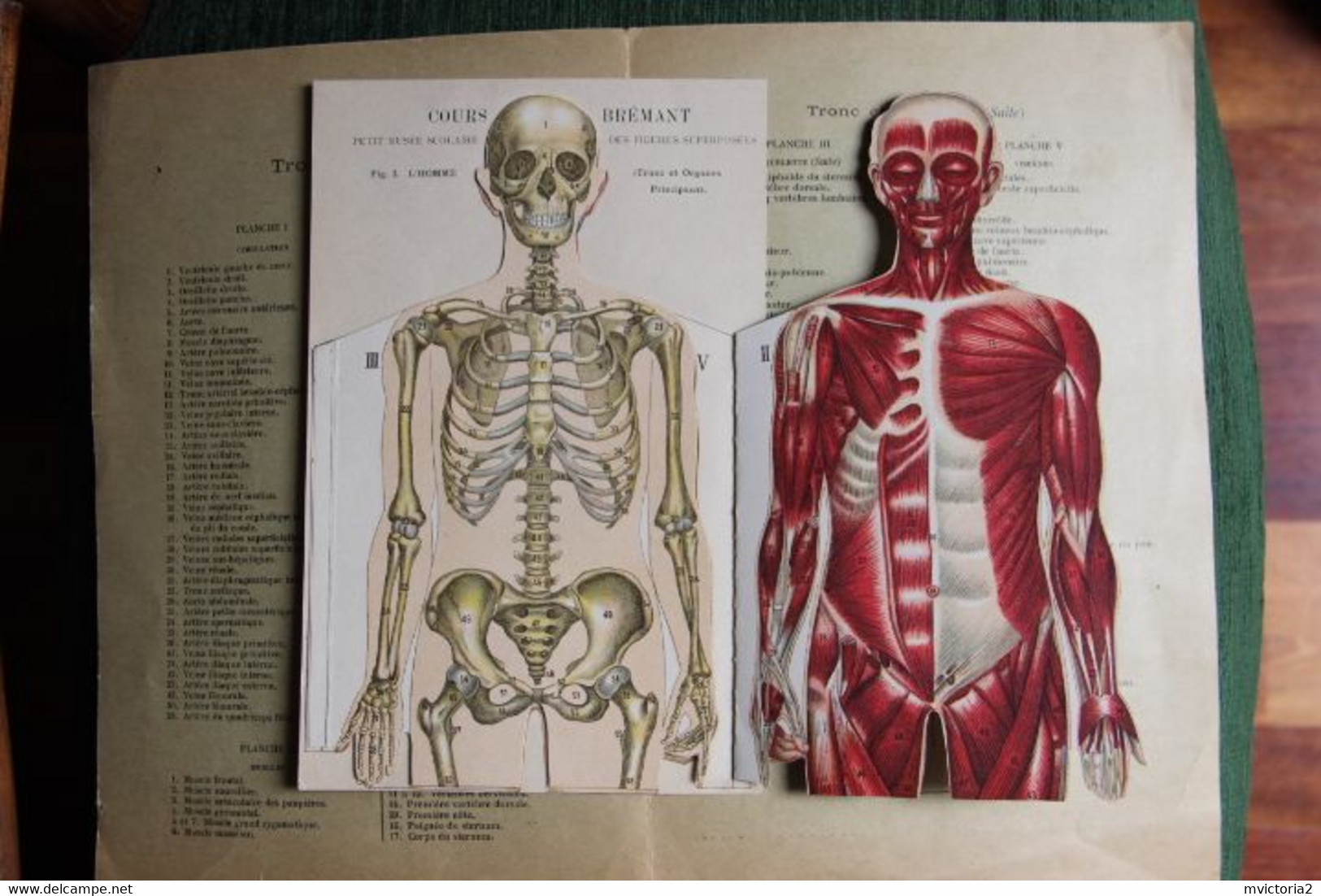 MEDECINE : Superbe Planche De Figures Superposées, Cours Brémant : Musée Scolaire : Tronc Et Membres. - Otros Planes