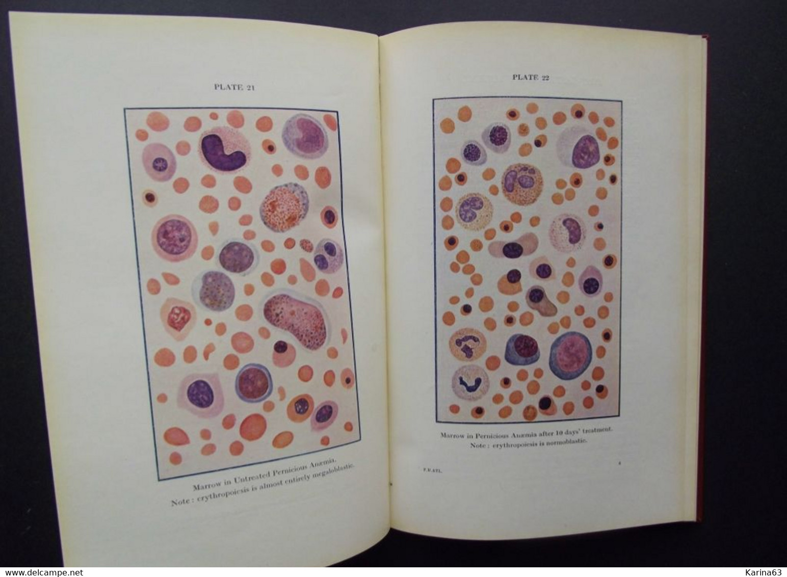 Clinical Atlas Of Blood Diseases - By A. Piney M.D M.R.C.P - Stanl Wyard M.D. F.R.C.P. - 48 Illutrations - 45 Coloured ! - 1900-1949