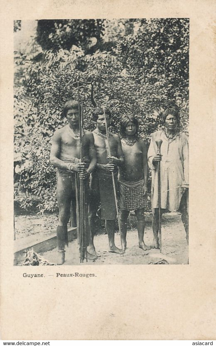 Indiens Peaux Rouge En Guyane .  Nude Men And Woman With Lances .  Undivided Back Indians - Amérique