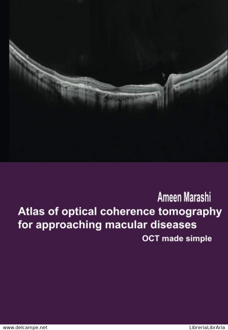 Atlas Of Optical Coherence Tomography For Approaching Macular Diseases OCT Made Simple - Medicina, Psicologia