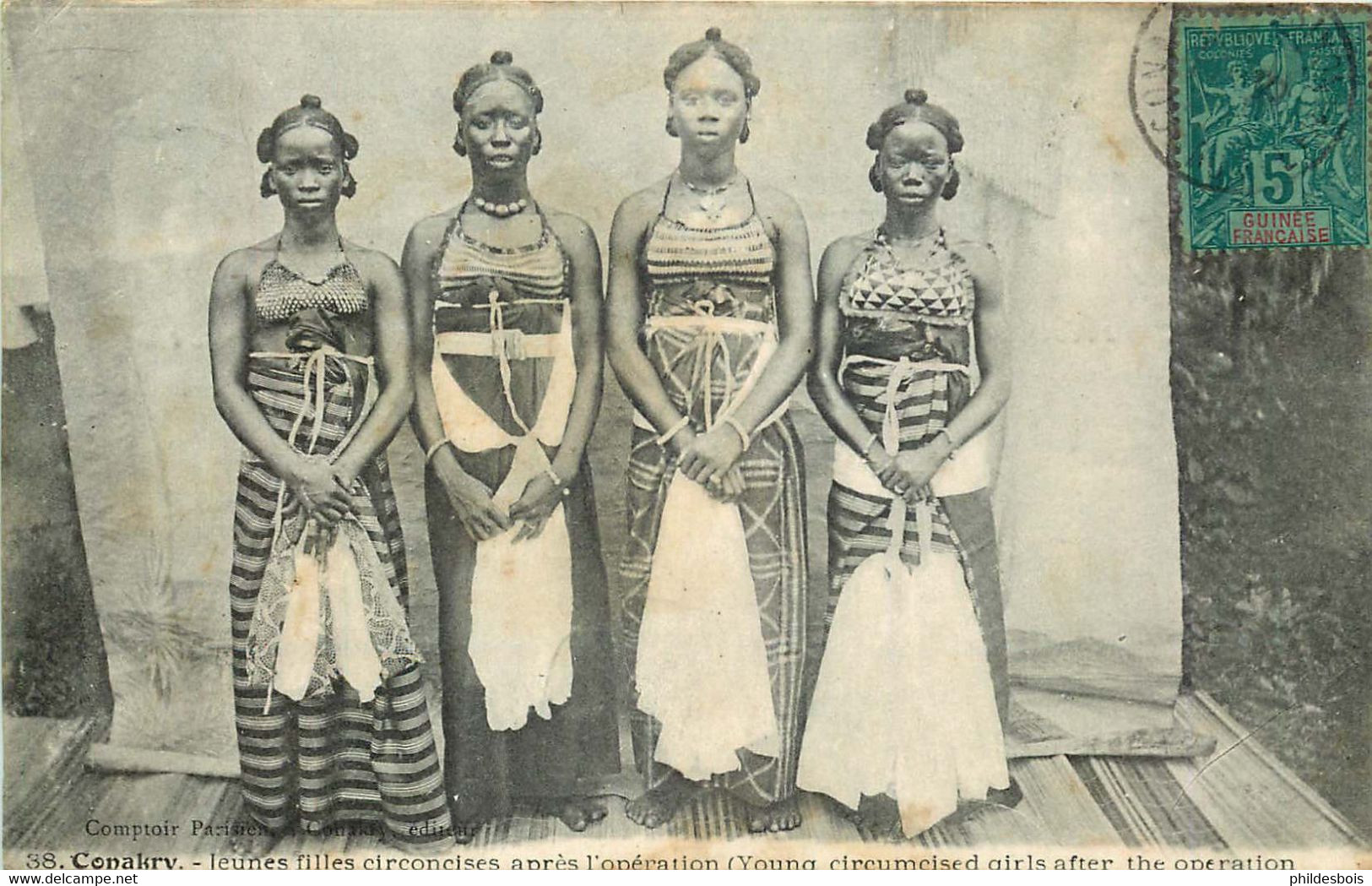 GUINÉE  CONAKRY  Jeunes Filles Circoncises Apres L'opération - French Guinea