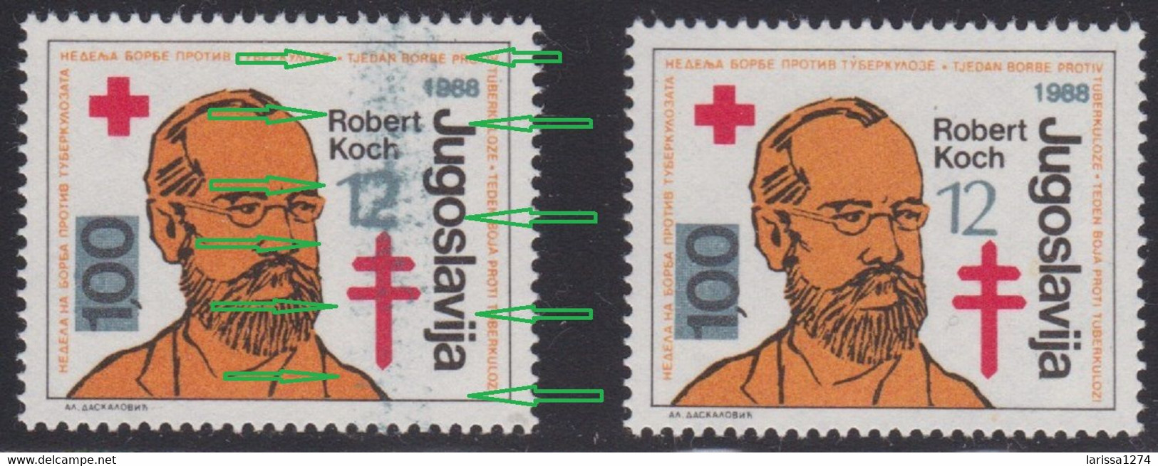 445. Yugoslavia 1988 Surcharge Robert Koch ERROR Stained Overprint MNH Michel #165 - Non Dentelés, épreuves & Variétés