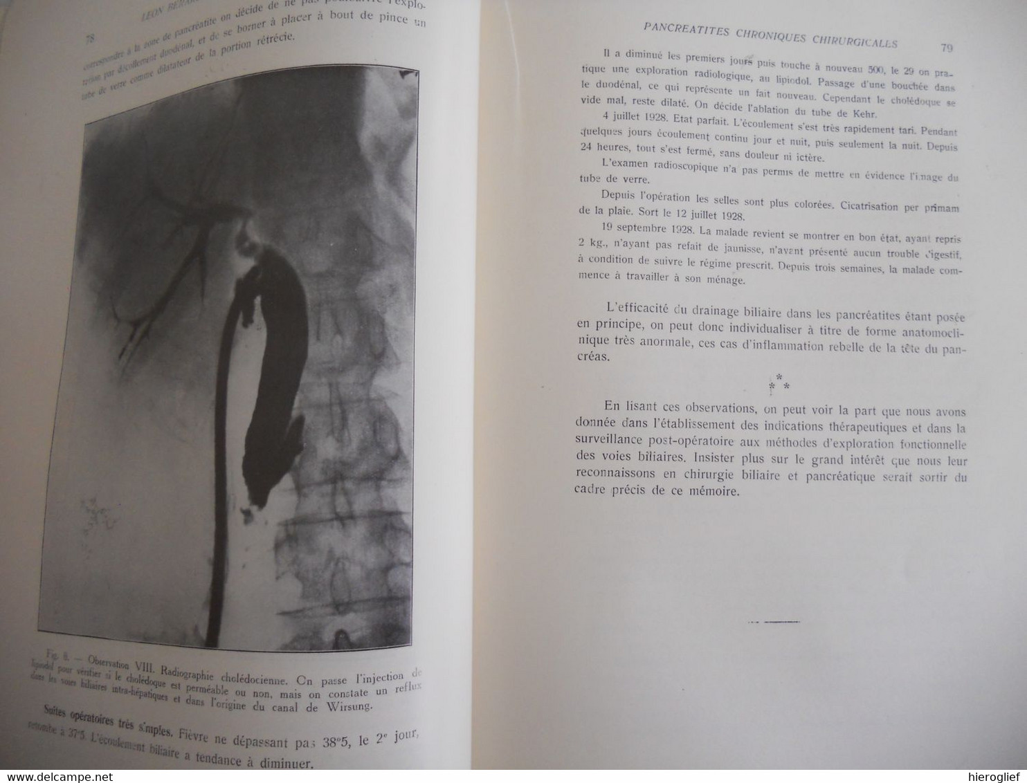 Livre Jubilaire Professeur Jean VERHOOGEN ° Molenbeek-Saint-Jean + Rhode-Saint-Genèse Université De Bruxelles Chirurgie - Chirurgie