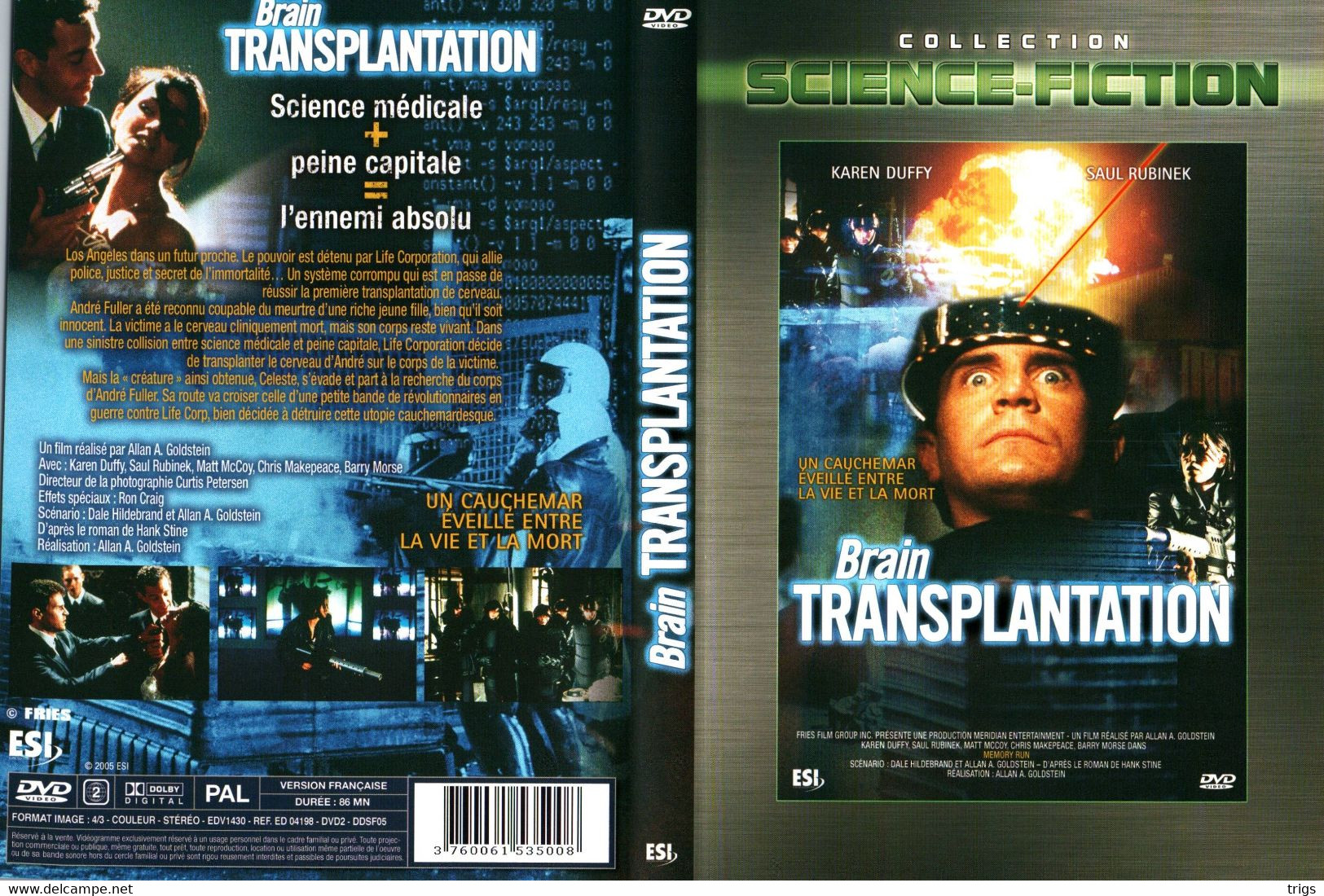 DVD - Brain Transplantation - Sciences-Fictions Et Fantaisie