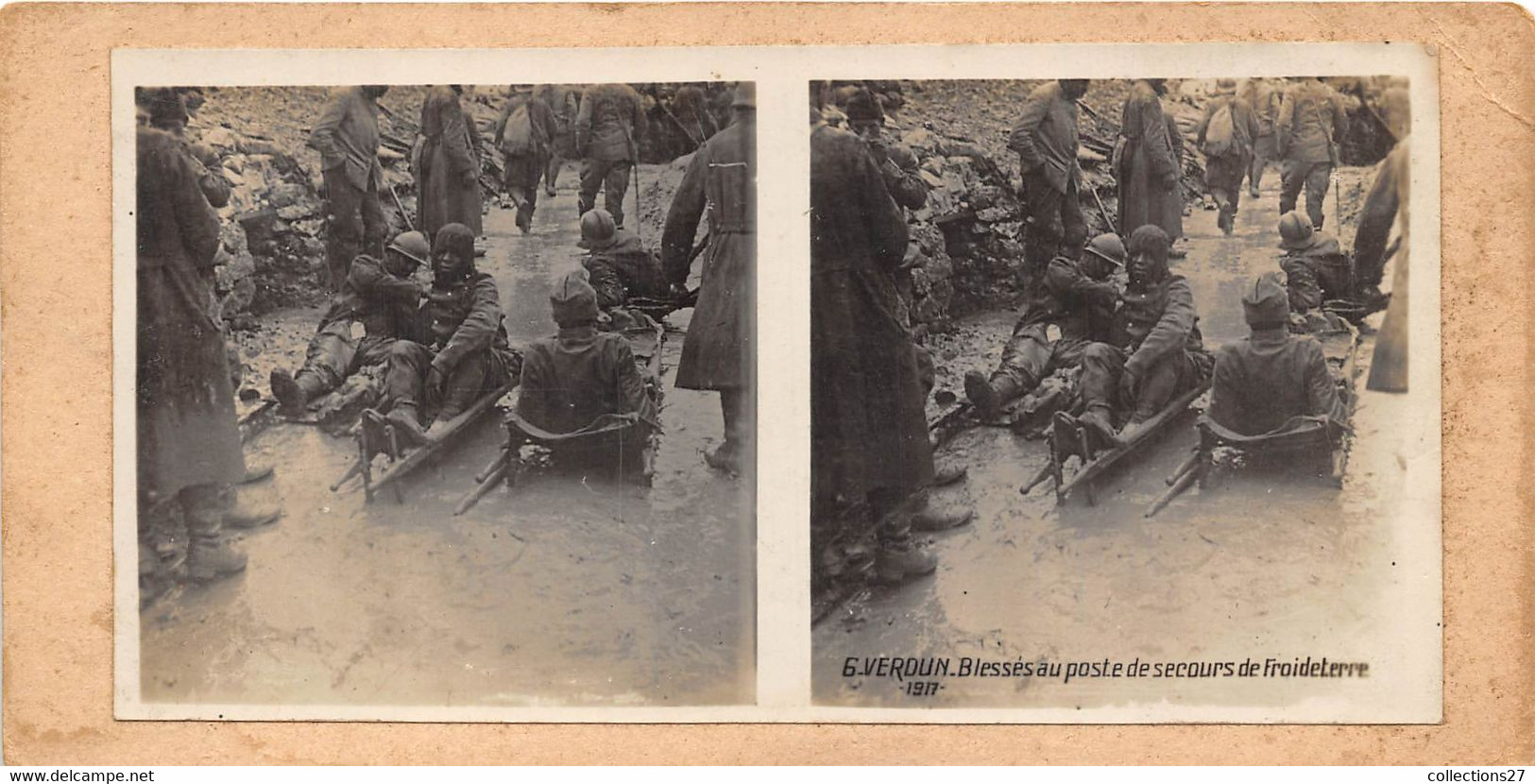 55-VERDUN- 1917 BLESSES AU POSTE DE SECOURS DE FROIDETERRE - Fotos Estereoscópicas