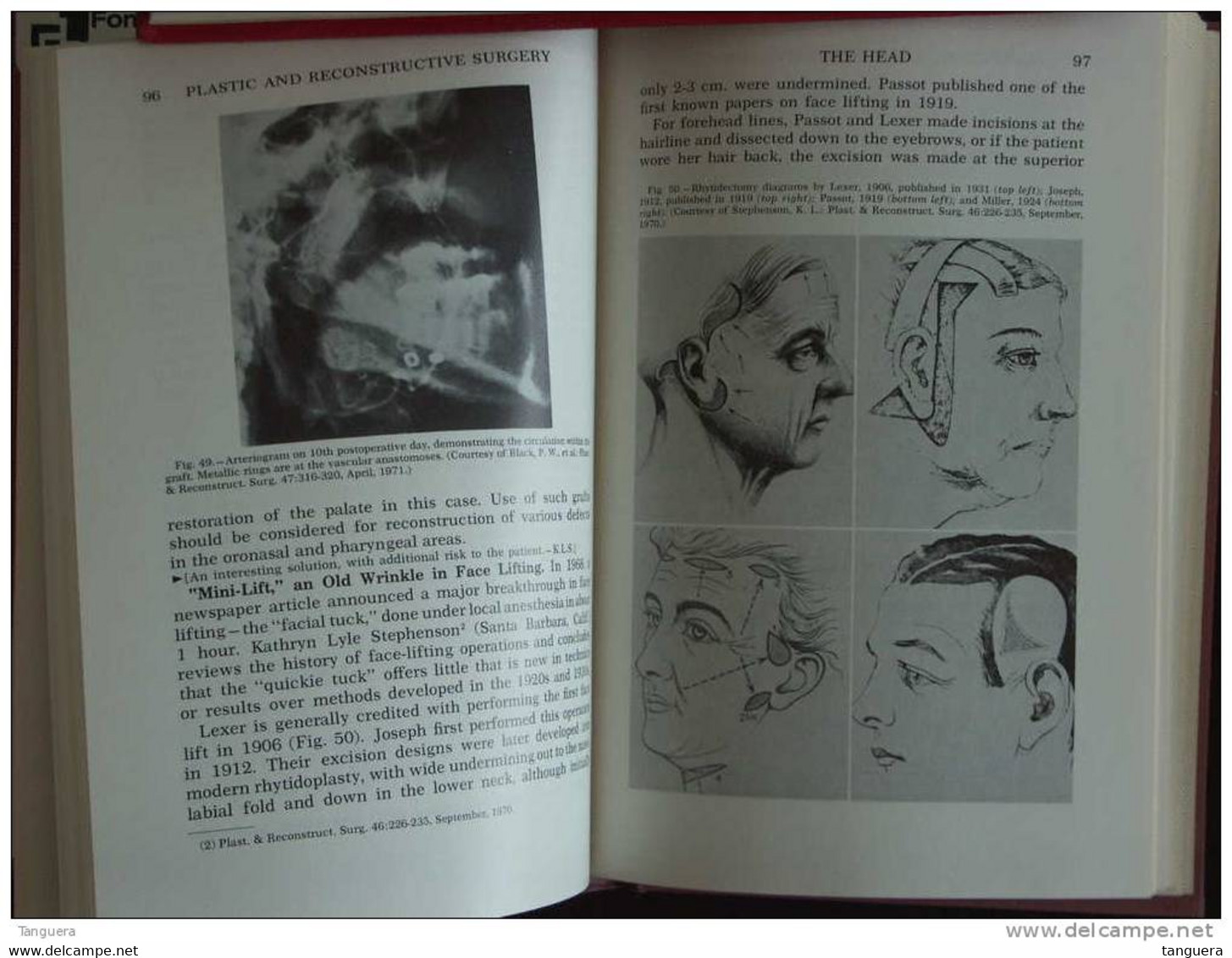 1972 Year Book Of PLASTIC AND RECONSTRUCTIVE SURGERY Stephenson Dingman Gaisford Haynes  - Year Book Publishers Chicago - Surgery