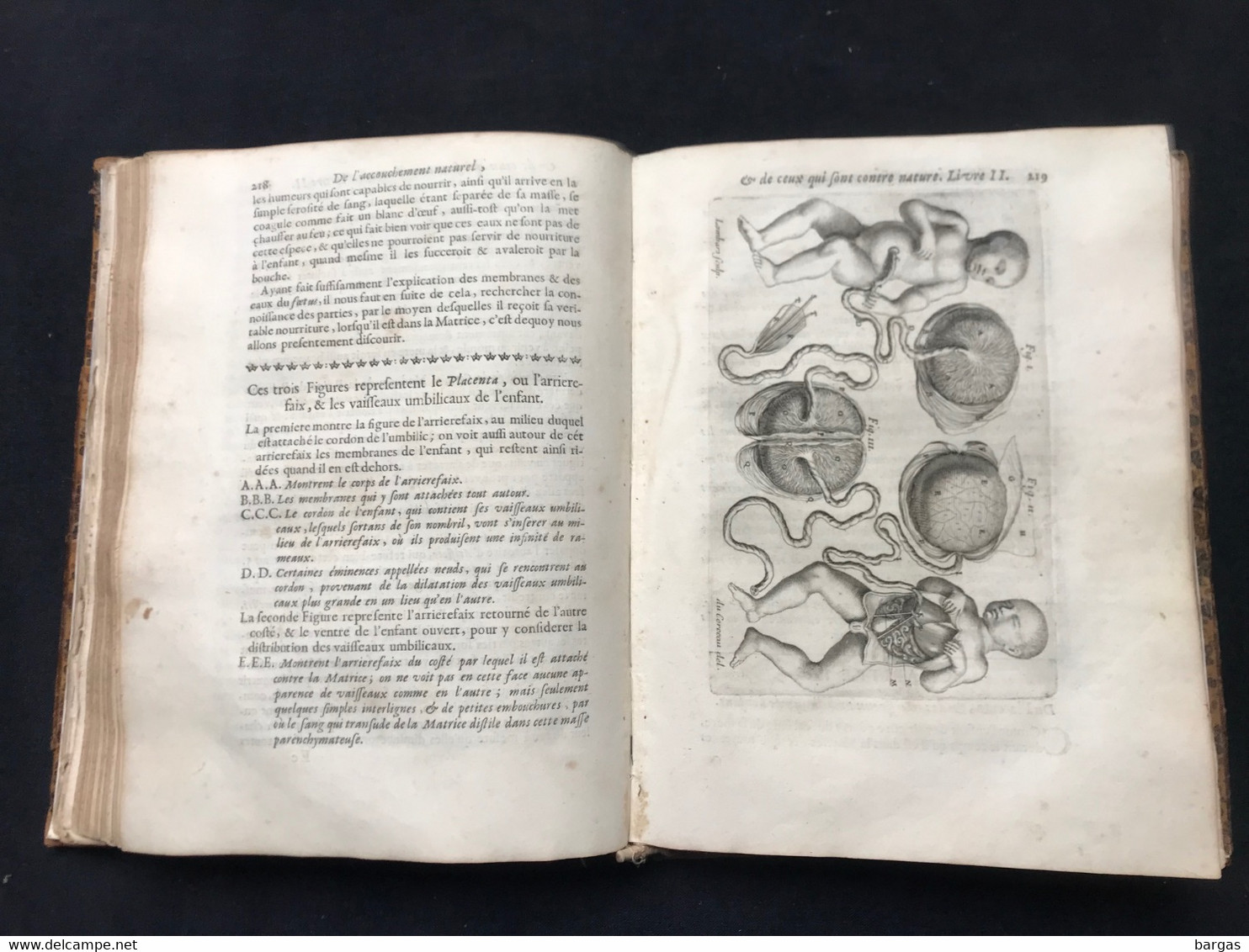 1675 - Médecine - Traité Des Maladies Des Femmes Grosses - Accouchement Gynécologie - Tot De 18de Eeuw