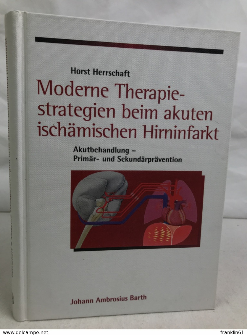 Moderne Therapiestrategien Beim Akuten Ischämischen Hirninfarkt : - Gezondheid & Medicijnen