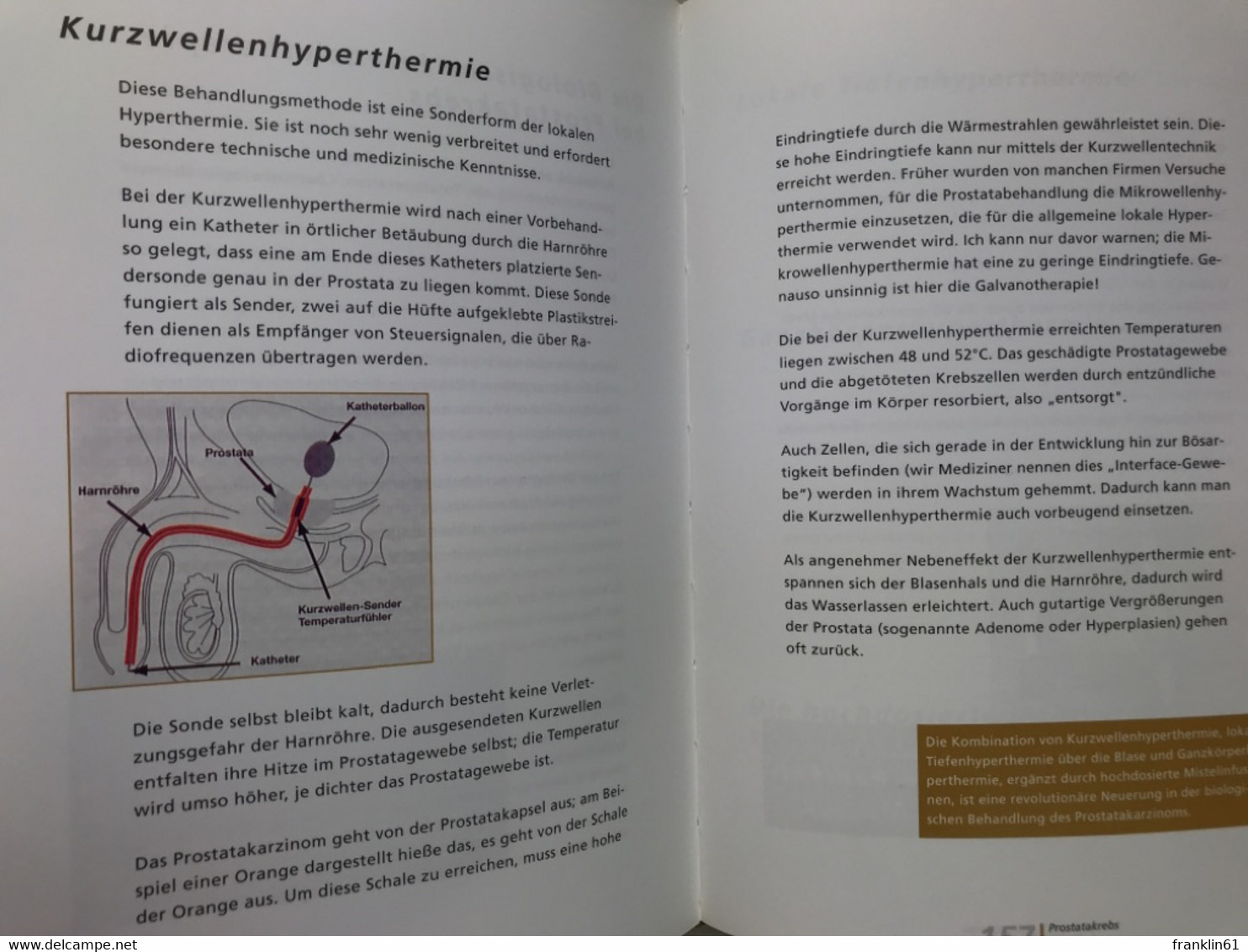 Rebell gegen den Krebs : Biologische Intensivtherapie - Neue Hoffnung für Patienten?