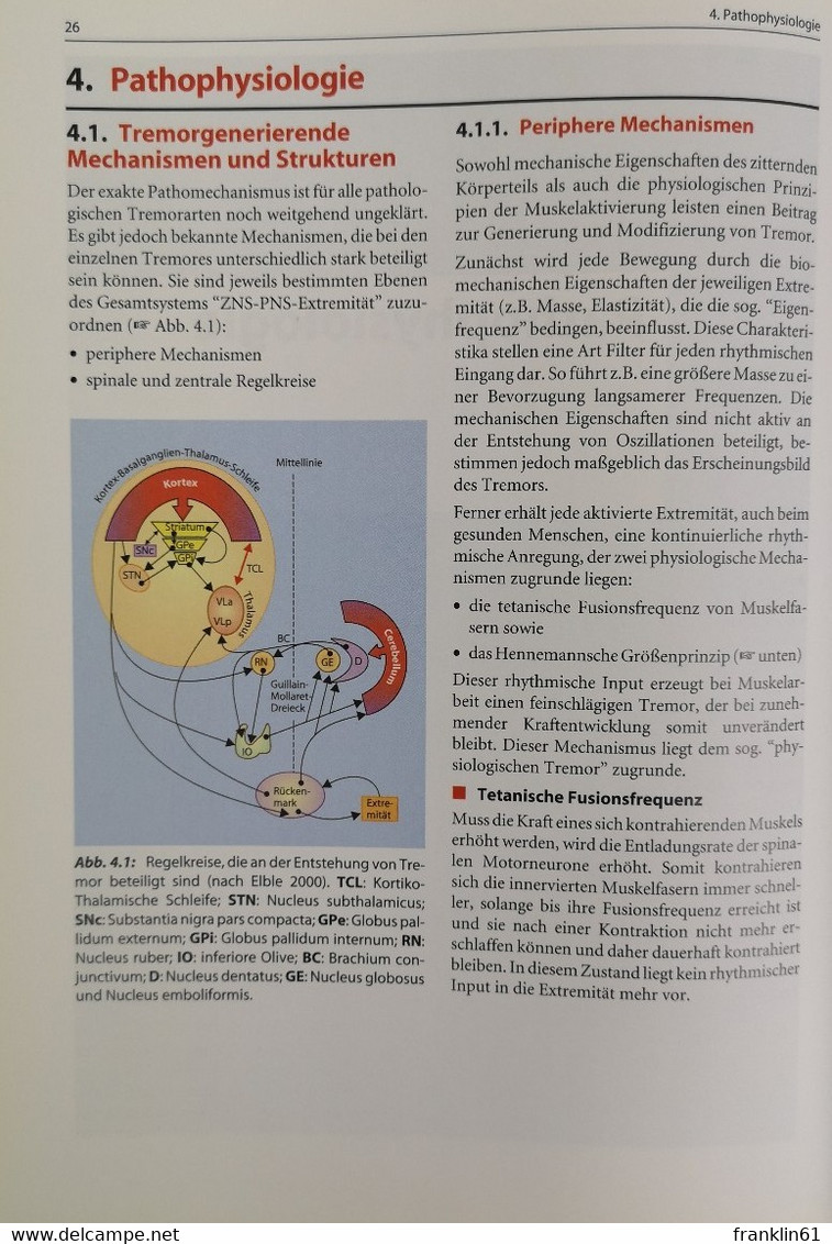 Tremor. Bei Morbus Parkinson Und Anderen Erkrankungen. - Gezondheid & Medicijnen