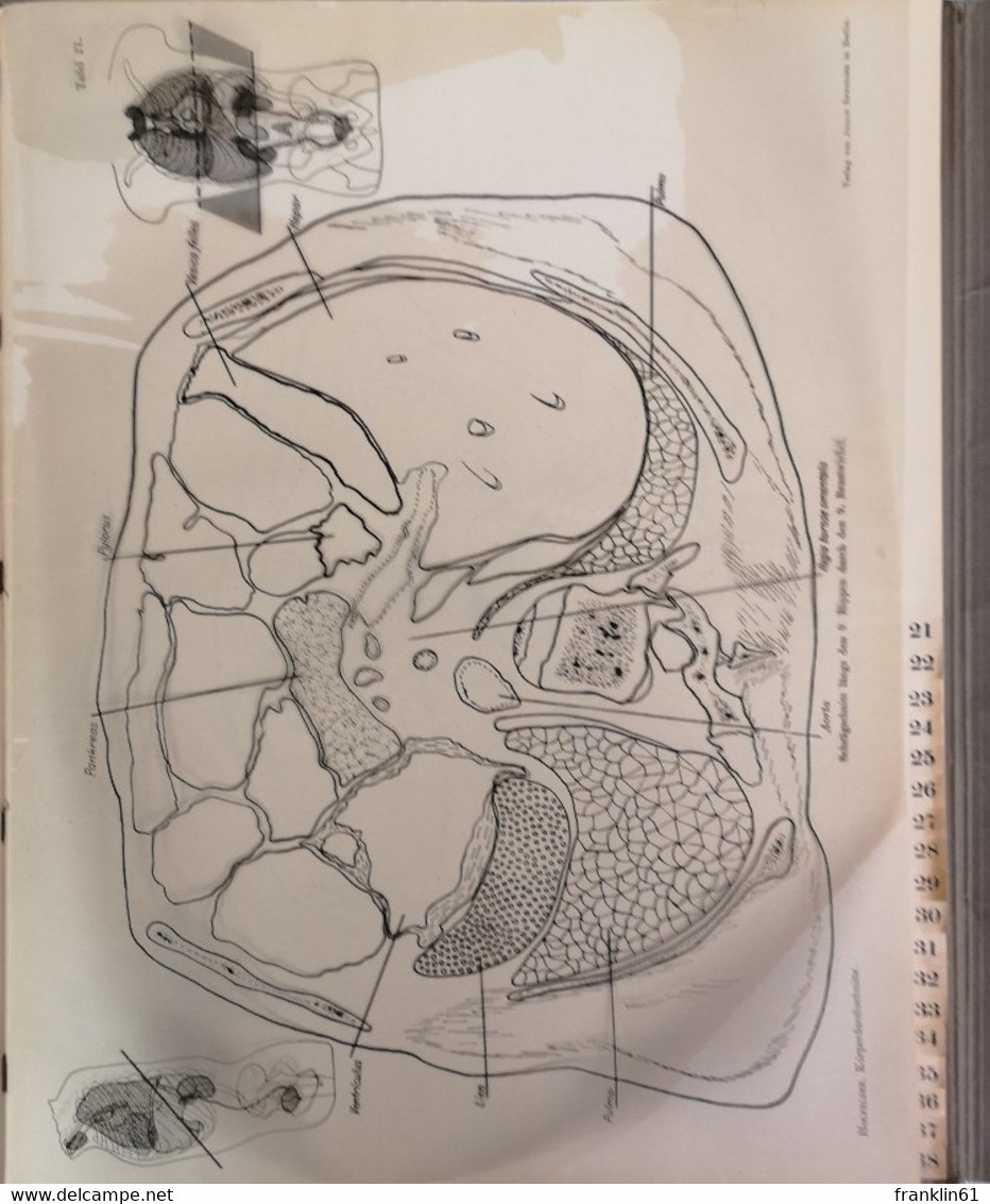 Atlas Von Körperdurchschnitten Für Die Anwendung In Der Röntgentiefentherapie. - Gezondheid & Medicijnen