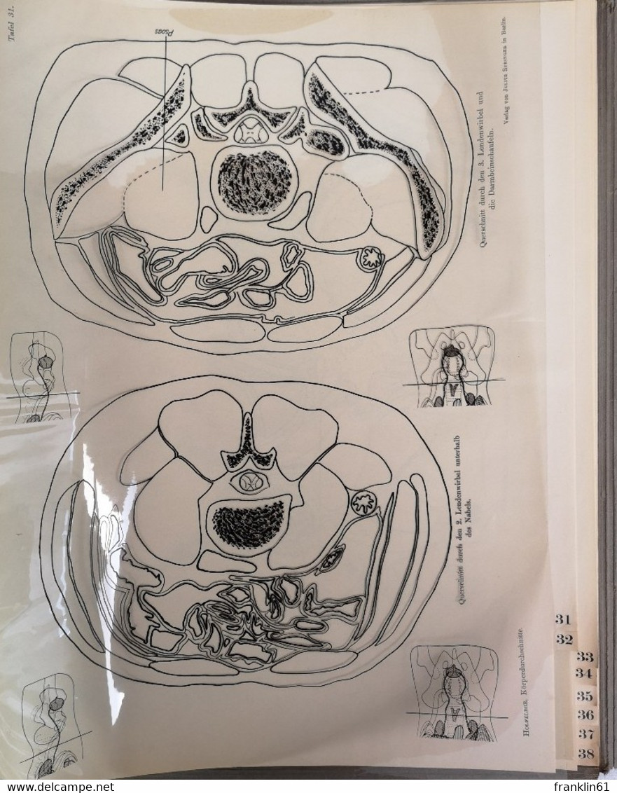 Atlas Von Körperdurchschnitten Für Die Anwendung In Der Röntgentiefentherapie. - Salud & Medicina