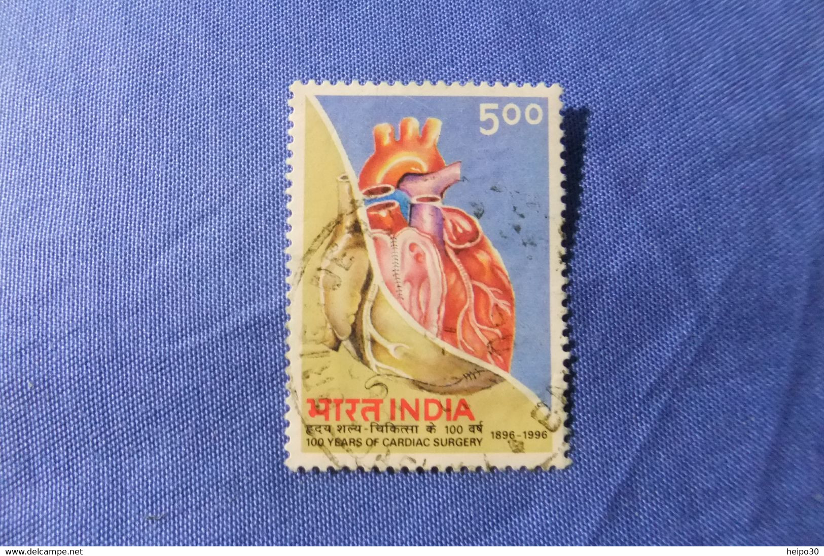 India 1996 Michel 1490 Herzchirurgie - Oblitérés