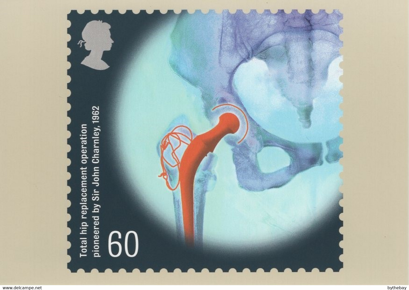 Great Britain 2010 PHQ Card Sc 2836 60p Total Hip Replacement Operation - Carte PHQ