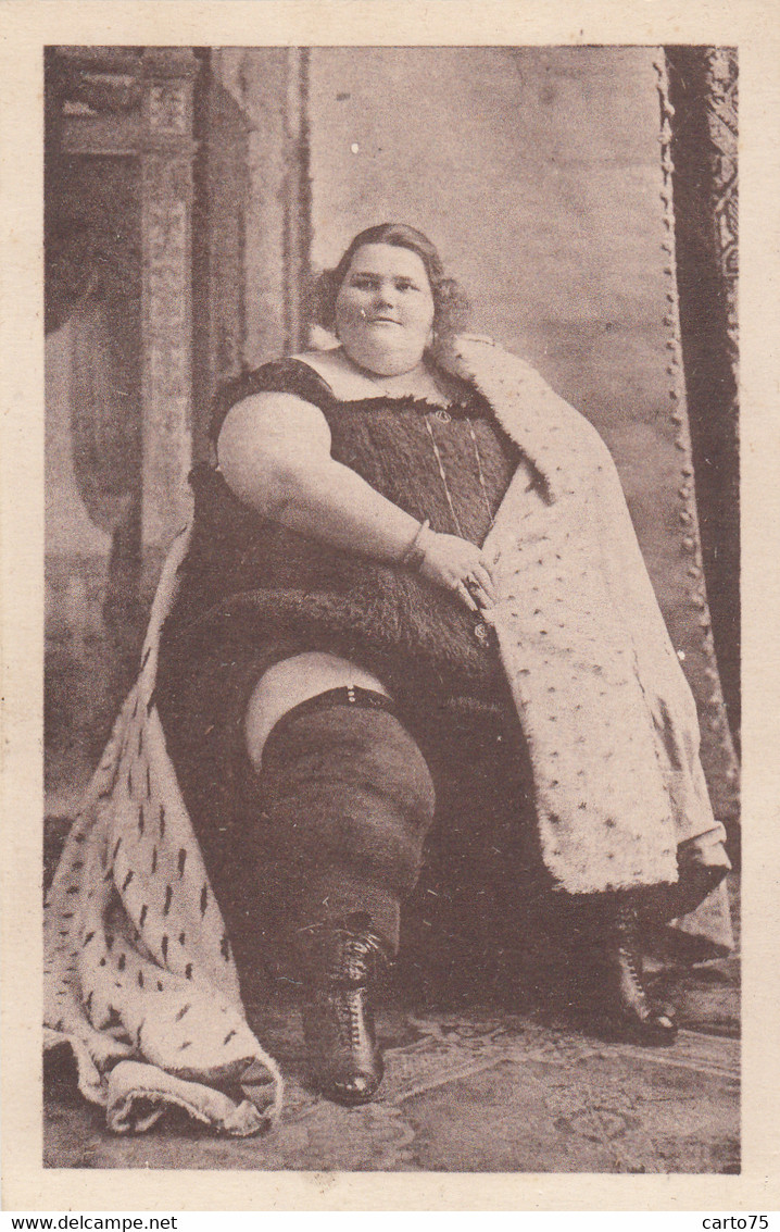 Santé - Médecine - Génétique - Obésité - Reine Des Colosses - Foire 1929 - Cirque - Santé