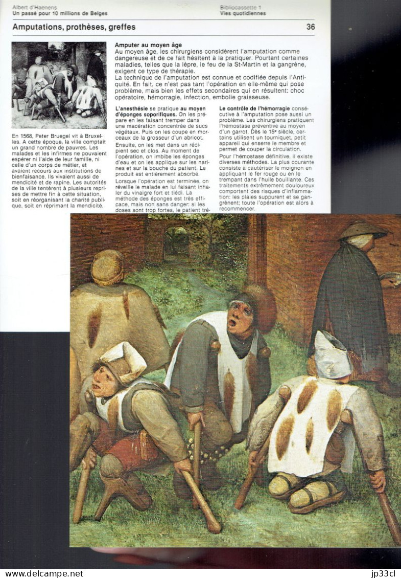 Amputations, Prothèses, Greffes : Image : Les Mendiants, Peinture De Pierre Bruegel L'Ancien - Learning Cards