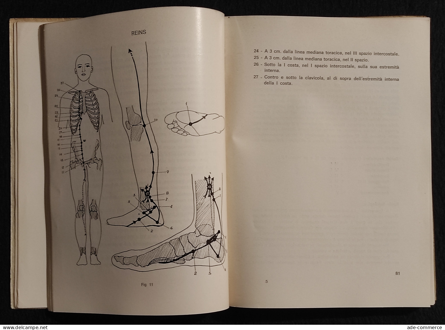 Agopuntura Moderna - Reflexologia - Ulderico Lanza - 1966 - Médecine, Psychologie