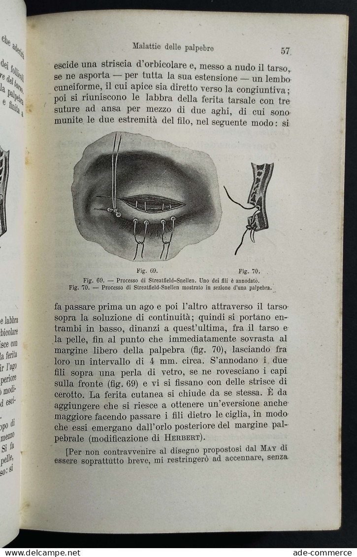 Manuale Delle Malattie Dell'Occhio - C. E. May - Ed. UTET - 1909 - Geneeskunde, Psychologie