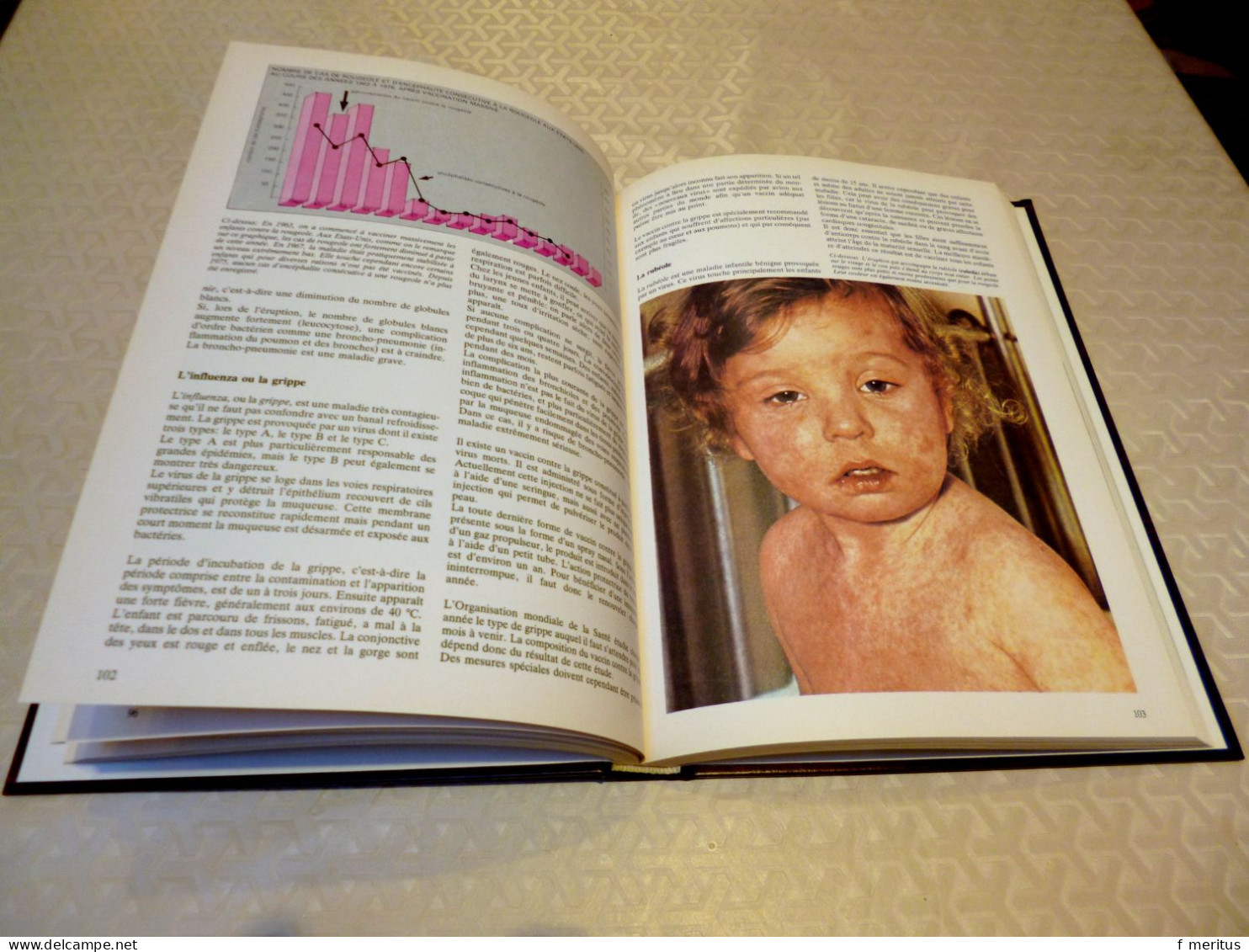 Nouvelle Encyclopédie De La Médecine  Les Maladies Infantiles Comme Neuf - Enciclopedie