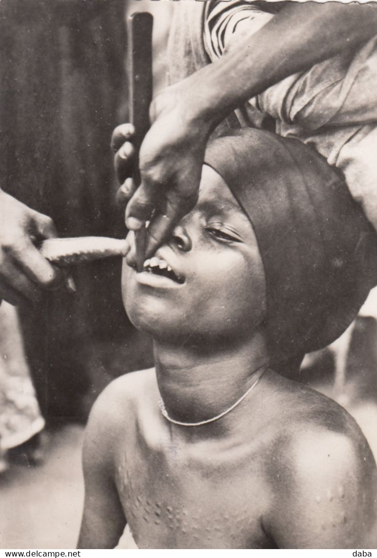 Benin.  Dahomey.  La Taille Des Dents - Benin
